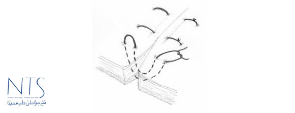 سوچرزنی