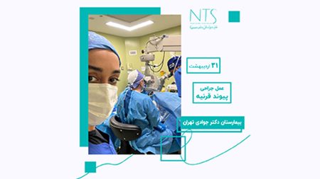 حضور در اتاق عمل پیوند قرنیه بیمارستان دکتر جوادی