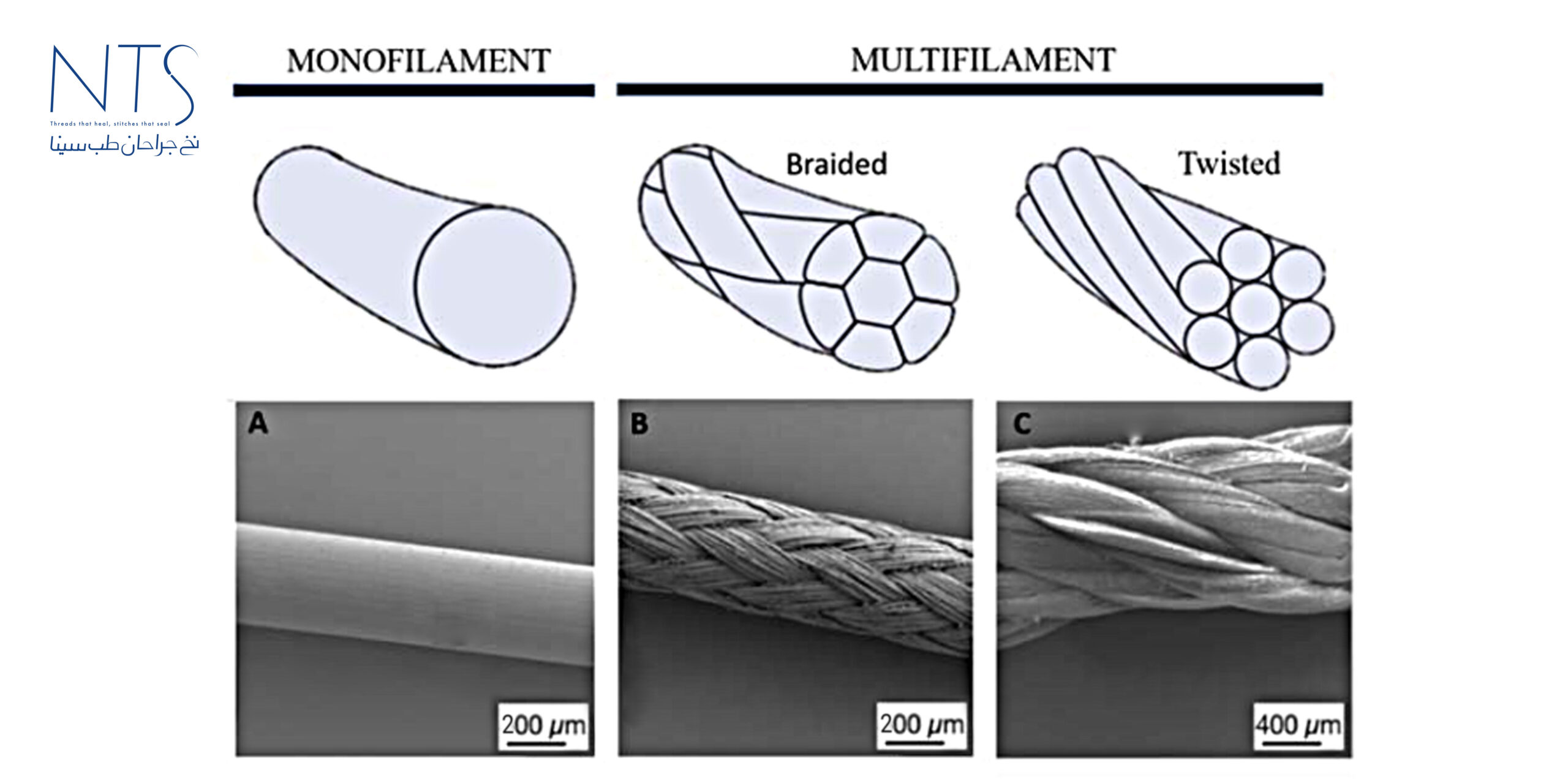 انواع نخ‌ بخیه