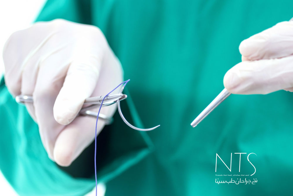 کاربرد نخ بخیه پلی گلاکتین