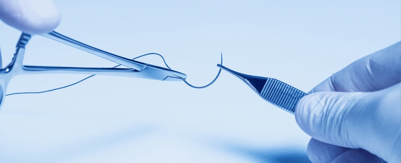 نخ های جراحی قابل جذب