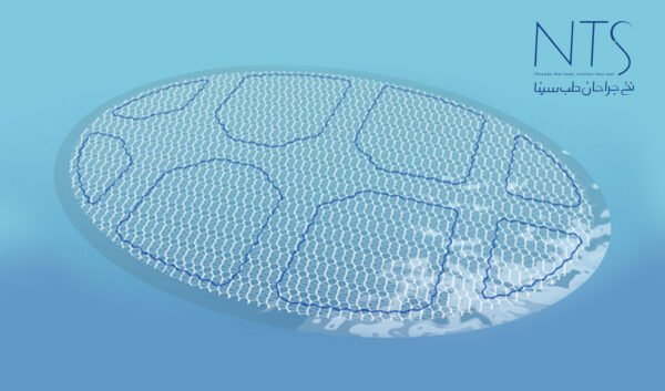 انواع مش جراحی و کاربرد آن