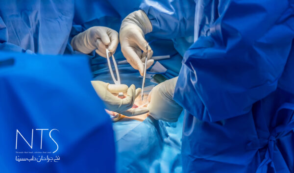 انواع مش جراحی و کاربرد آن