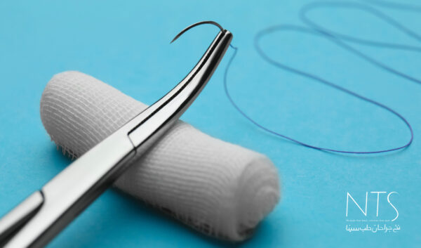 منشا تهیه انواع نخ‌ بخیه