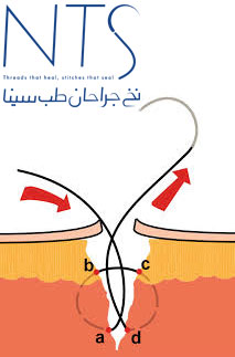 threads suture