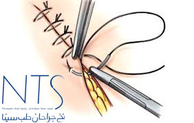 کرومیک