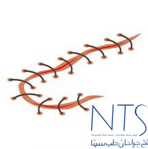 نخ بخیه