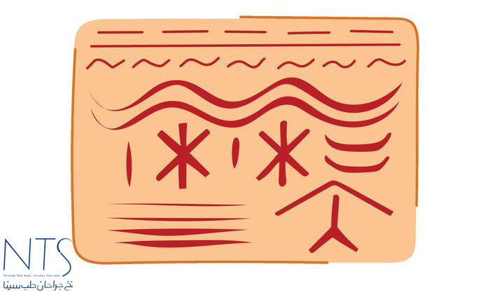 سوچرزنی