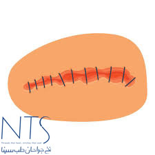 نخ بخیه 8