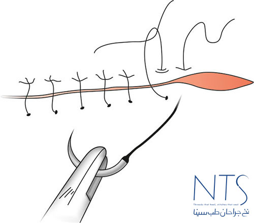 نخ و سوزن جراحی