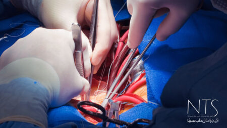 نخ بخیه در جراحی‌های قلب و عروق