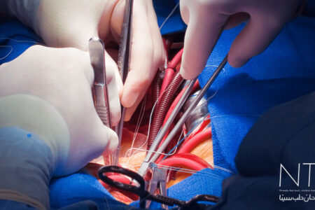 جراحی قلب و عروق