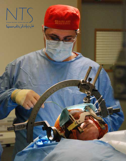 جراحی مغز و اعصاب