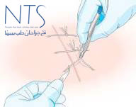 بخیه زنی