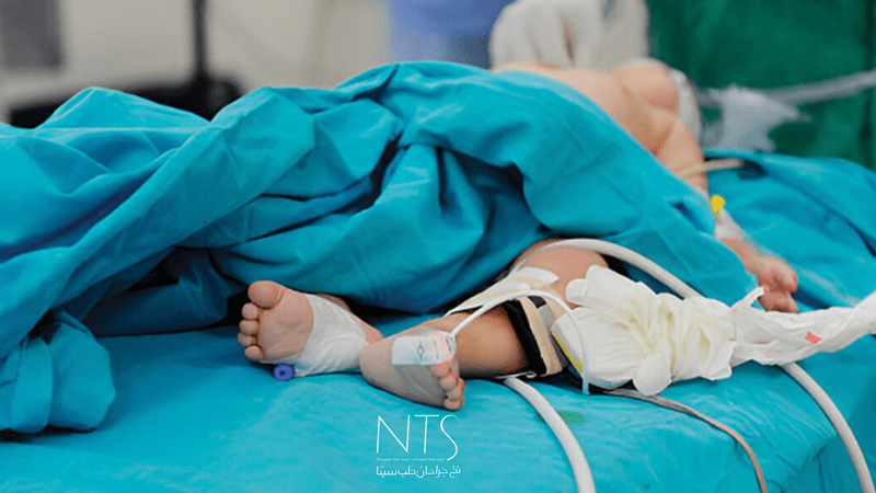 Pediatric-surgery