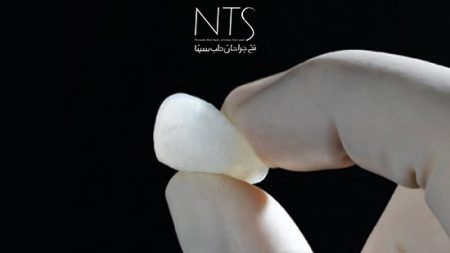 هر آنچه باید درباره بن وکس بدانید