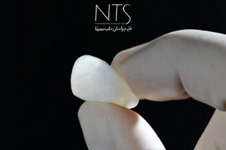 بن وکس