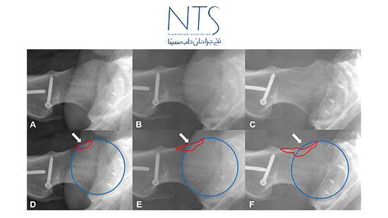 استفاده از بن وکس