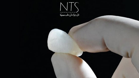بن وکس