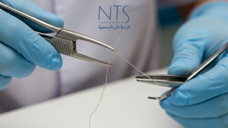 نخ بخیه پلی گلایکولیک اسید (ویکریل رپید) چیست