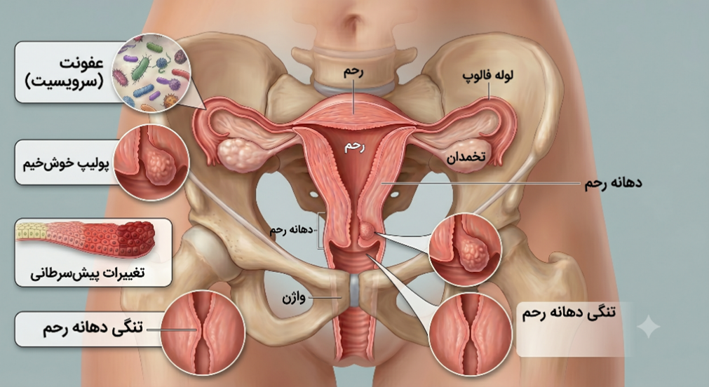 جراحی زنان