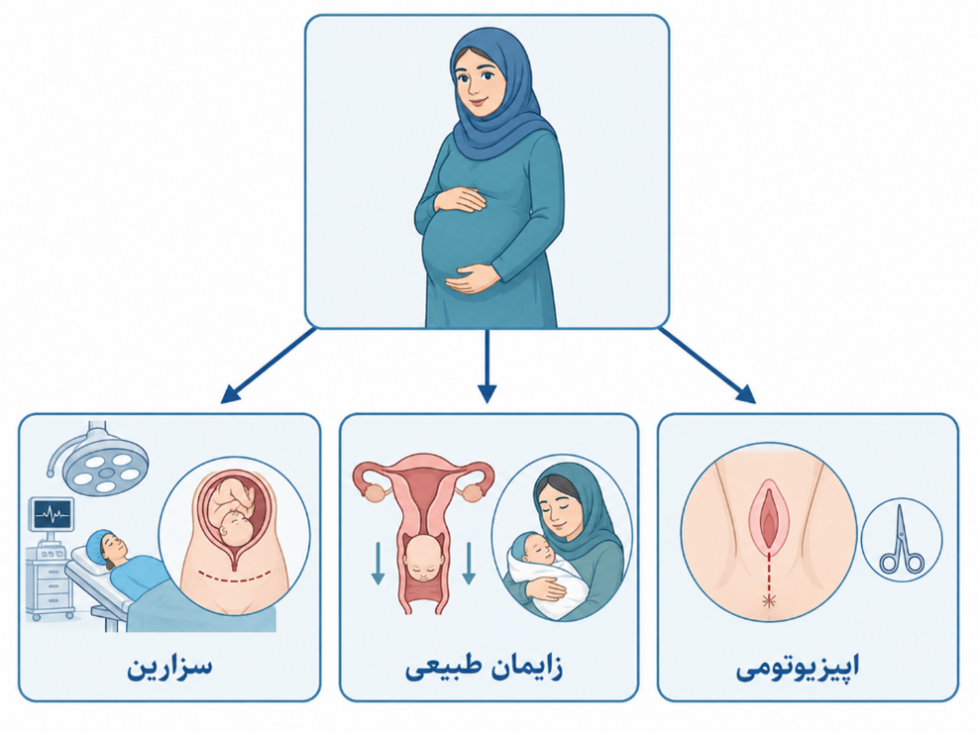 جراحی زایمان