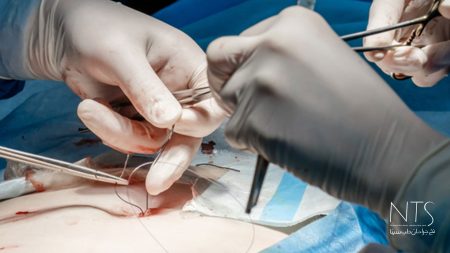 نکات ایمنی در استفاده از نخ بخیه